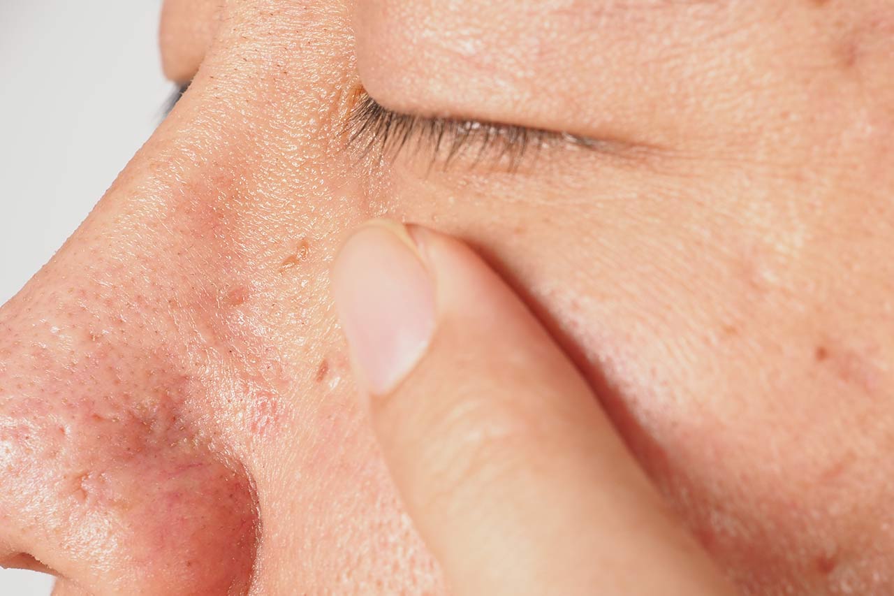 沖縄の紫外線はなぜ危険？友利新先生が教える“肌と健康を守る”正しい紫外線対策