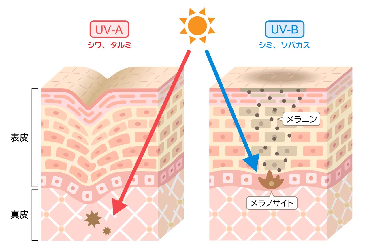 沖縄の日差しが危険な理由　友利新先生に聞くUVA・UVBと正しい防ぎ方