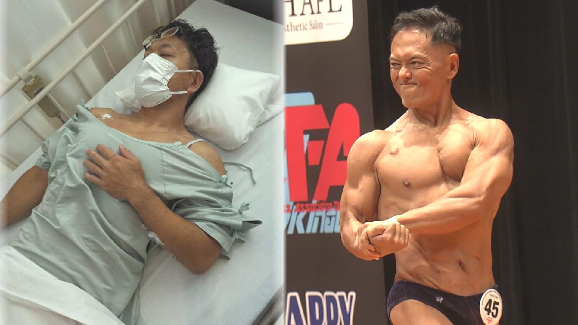ステージ4の大腸がん…手術4回・抗がん剤40回以上「絶対に負けない」と絶望の淵から救ってくれた人生の全てとは