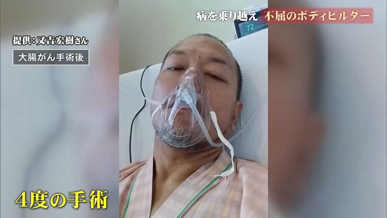 「筋トレは人生の全て」　ステージ4の大腸がんと戦うボディビルダーが体現する「生きる力」